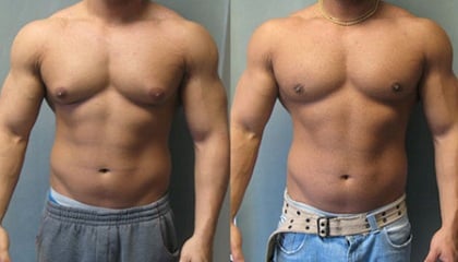 First steroid cycle before and after pics
