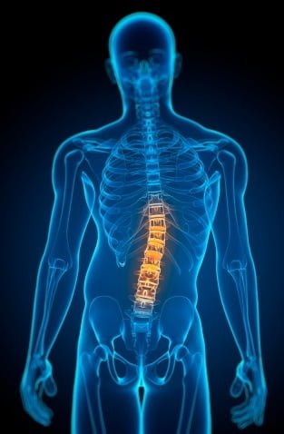 Escoliose exercícios indicados na musculação