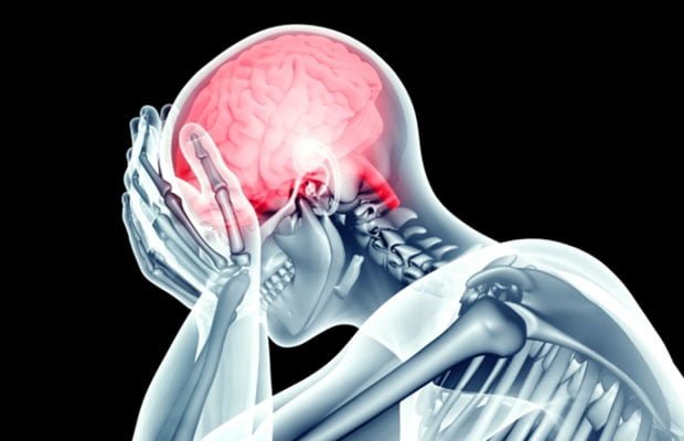 AVC acidente vascular cerebral AVC acidente vascular cerebral